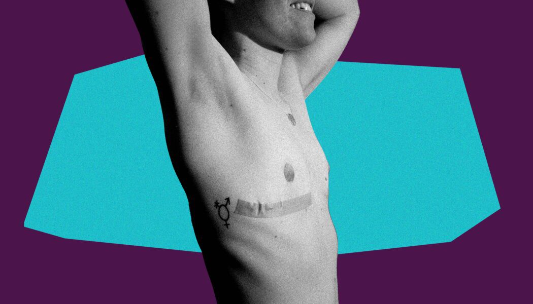 Busting the myths around transition regret and detransition