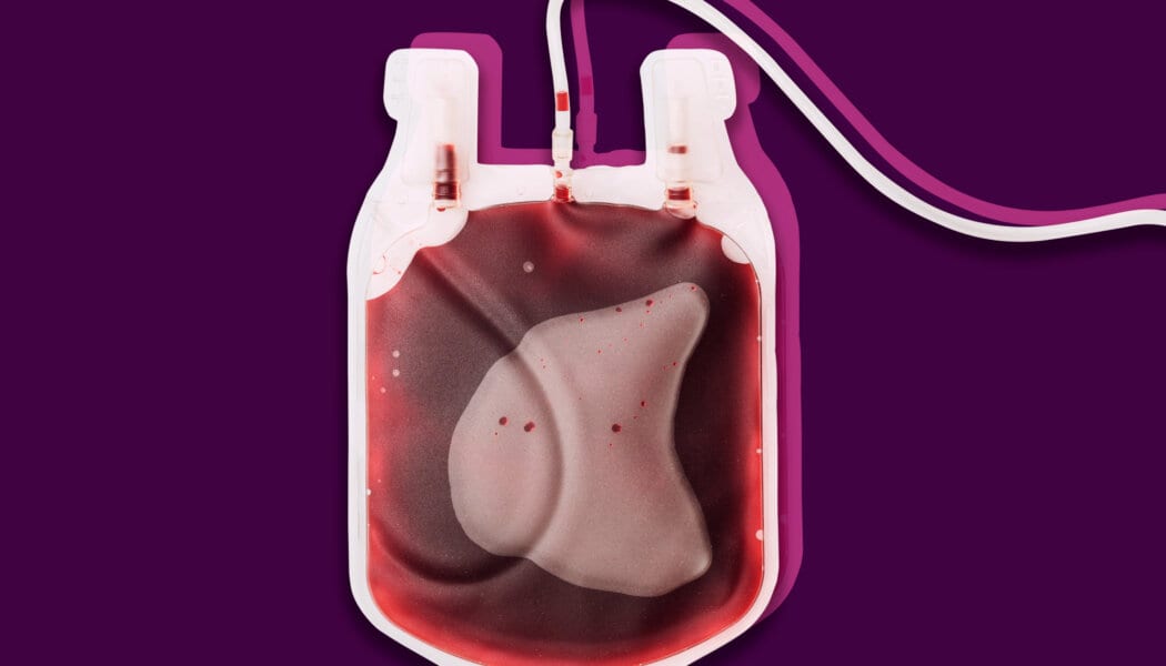 Amid COVID-19, lawmakers call to end blood donation bans for queer men